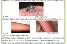 2015年のデング熱対策…検査キットや保険適用化を進める東京都