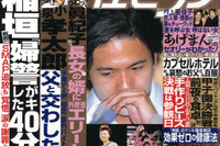 ヒゲ、白く写ってます---稲垣吾郎謝罪会見 画像