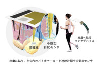 本田技術研究所、皮膚に貼る新型センサー共同開発…血糖値の連続モニタリングが可能に 画像