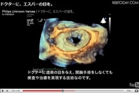 人体3D透視技術など、フィリップスの知られざる技術がネットに 画像