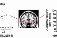 正直者と嘘つきの脳の違いを解明…京大研究グループ 画像