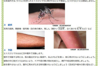 2015年のデング熱対策…検査キットや保険適用化を進める東京都 画像