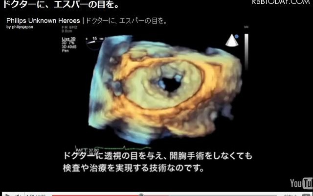 ムービー「人体を、3Dで透視する」の一場面 ムービー「人体を、3Dで透視する」の一場面