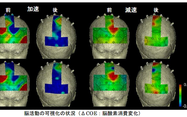 脳活動の可視化の状況