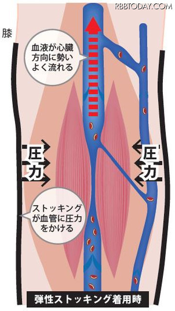 「JETLEGS」は一般医療機器として認定を受けており、市販のサポートストッキングよりも高い圧迫圧で血流をスムーズにする（画像はプレスリリースより）