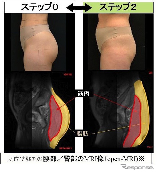 ヒップの形が変化するのは、単に脂肪がついてくるだけでなく、「内部がゆるむ」から