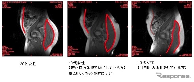 「日常の歩行（よい姿勢で歩幅を広く、速く)をサポートする」提案