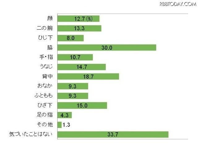 夏に向けて女性の露出が多くなるこの時期、あなたは女性のムダ毛に気づいたことがありますか(n=300)