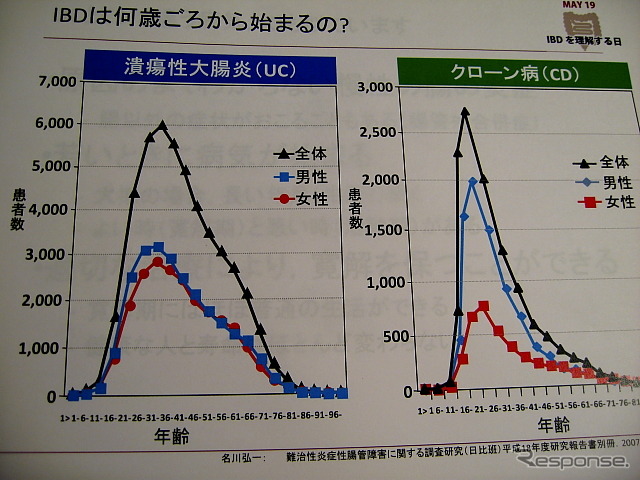 IBDは10~20代の発症が多くみられる