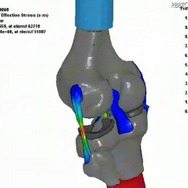 人体モデル開発例 膝の曲げ試験 人体モデル開発例 膝の曲げ試験