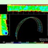 あたり箇所のヒートマップ表示（切羽掘削形状モニタリングシステム）