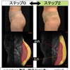 ヒップの形が変化するのは、単に脂肪がついてくるだけでなく、「内部がゆるむ」から