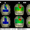 脳活動の可視化の状況