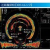 古野電気、全周型カラースキャニングソナー「FSV-25」を開発