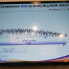 EVSとAMR-WB/AMRによる音声の比較を聴き比べることもできた