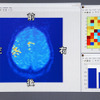 【ホンダ脳インターフェイス】脳活動をデコーディングする