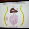 内臓脂肪の蓄積がメタボリック症候群を引き起こす